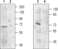 Anti-MCOLN1 antibody used in Western Blot (WB). GTX16615