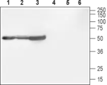 Anti-Cav beta 1 antibody used in Western Blot (WB). GTX16620