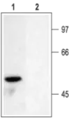 Anti-Kv1.6 antibody used in Western Blot (WB). GTX16638
