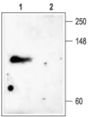 Anti-KCNC4 antibody used in Western Blot (WB). GTX16643