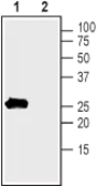 Anti-KCNMB1 antibody used in Western Blot (WB). GTX16646