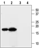 Anti-KCNE3 antibody used in Western Blot (WB). GTX16690