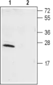 Anti-KCNIP1 antibody used in Western Blot (WB). GTX16713