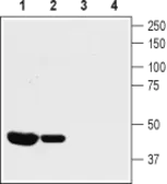 Anti-KCNA10 antibody used in Western Blot (WB). GTX16755