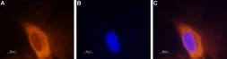 Anti-SCN3A antibody used in Immunocytochemistry/ Immunofluorescence (ICC/IF). GTX16937