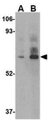 Anti-DHX58 antibody used in Western Blot (WB). GTX16994