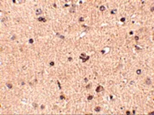 Anti-SLITRK2 antibody used in IHC (Paraffin sections) (IHC-P). GTX16999
