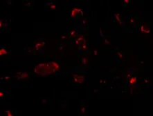 Anti-SLITRK2 antibody used in IHC (Paraffin sections) (IHC-P). GTX17000