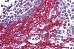 Anti-FOXO3A antibody, C-term used in IHC (Paraffin sections) (IHC-P). GTX17026