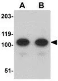 Anti-AFAP1L2 antibody used in Western Blot (WB). GTX17041