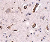 Anti-GALNT10 antibody used in IHC (Paraffin sections) (IHC-P). GTX17042