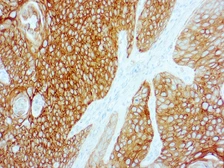 Anti-Cytokeratin 5 + 6 antibody [D5/16 B4] (ready-to-use) used in IHC (Paraffin sections) (IHC-P). GTX17068
