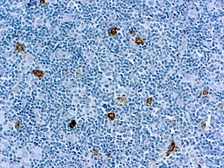 Anti-SSEA-1 / CD15 antibody [MMA (LeuM1)] used in IHC (Paraffin sections) (IHC-P). GTX17080