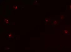 Anti-CD160 antibody used in Immunocytochemistry/ Immunofluorescence (ICC/IF). GTX17209