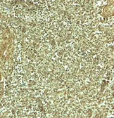Anti-ADRM1 antibody used in IHC (Paraffin sections) (IHC-P). GTX17239