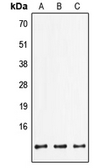 Anti-FXYD2 antibody used in Western Blot (WB). GTX17440