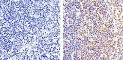 Anti-NFkB p65 (phospho Ser529) antibody used in IHC (Paraffin sections) (IHC-P). GTX17575