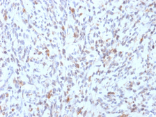 Anti-MyoD1 antibody [rMYD712] used in IHC (Paraffin sections) (IHC-P). GTX17751