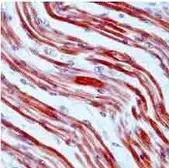 Anti-Tropomyosin antibody [SPM224] used in IHC (Paraffin sections) (IHC-P). GTX17784