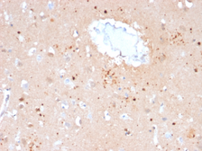 Anti-Ubiquitin antibody [UBB/2122] used in IHC (Paraffin sections) (IHC-P). GTX17824