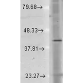 Anti-Rhodopsin antibody [1D4] (Biotin) used in Western Blot (WB). GTX18143