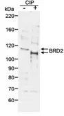 Anti-BRD2 antibody used in Western Blot (WB). GTX19276