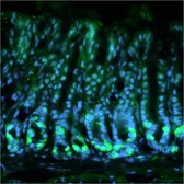 Anti-Calcium Sensing Receptor antibody [5C10, ADD] used in IHC (Frozen sections) (IHC-Fr). GTX19347
