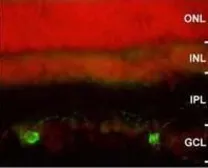 Anti-Melanopsin antibody used in Immunohistochemistry (IHC). GTX19383