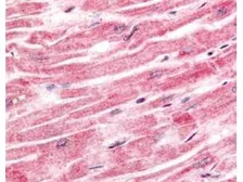 Anti-SPRY4 antibody used in IHC (Paraffin sections) (IHC-P). GTX20265