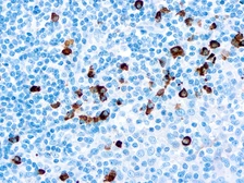 Rabbit Anti-Human IgA antibody (ready-to-use). GTX20937