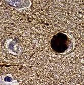Anti-alpha Synuclein antibody [4B12] used in Immunohistochemistry (IHC). GTX21904