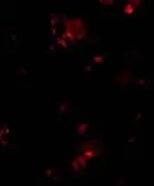 Anti-DcR1 antibody used in Immunocytochemistry/ Immunofluorescence (ICC/IF). GTX22087