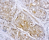 Anti-MMP9 antibody used in IHC (Paraffin sections) (IHC-P). GTX22167