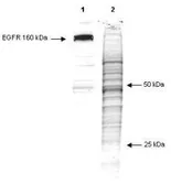 Anti-Phosphotyrosine antibody [13F9] used in Western Blot (WB). GTX22287
