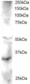 Anti-FRAT2 antibody used in Western Blot (WB). GTX22470