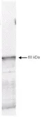 Anti-Pyruvate dehydrogenase kinase 1 / PDK1 antibody used in Western Blot (WB). GTX22495