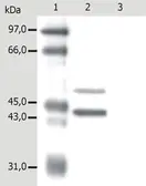 Anti-Cytokeratin 5 + 18 antibody [C-50] used in Western Blot (WB). GTX22535