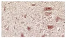 Anti-NMDAR3A + NMDAR3B antibody [K35/40] used in IHC (Frozen sections) (IHC-Fr). GTX22639