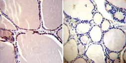Anti-CRABP1 antibody [C-1] used in IHC (Paraffin sections) (IHC-P). GTX22816