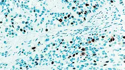 Anti-Topoisomerase II alpha antibody [3F6] used in IHC (Paraffin sections) (IHC-P). GTX23111