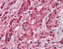 Anti-TRPM8 antibody used in IHC (Paraffin sections) (IHC-P). GTX23243