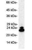 Anti-LMP2 antibody used in Western Blot (WB). GTX23328