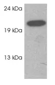 Anti-RAB3C antibody used in Western Blot (WB). GTX23336