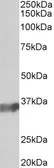 Anti-BOB1 antibody used in Western Blot (WB). GTX23426