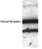 Anti-S-arrestin antibody used in Western Blot (WB). GTX23435