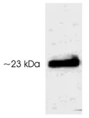 Anti-Serotonin N-AT (phospho Thr29) antibody used in Western Blot (WB). GTX23439
