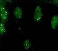 Anti-CSEN antibody used in Immunocytochemistry/ Immunofluorescence (ICC/IF). GTX23474