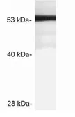 Anti-STARD3 antibody used in Western Blot (WB). GTX23478