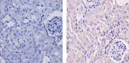 Anti-CaMK1 antibody used in IHC (Paraffin sections) (IHC-P). GTX23551