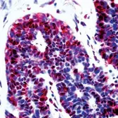 Anti-CDKN2A / p14ARF antibody used in Immunohistochemistry (IHC). GTX23642